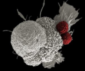What happens in CAR T-Cell Therapy when T cells attack cancer cells 