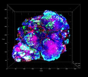 Transparent tumor tomography of tumor hypoxia. Credit NIH, NCI